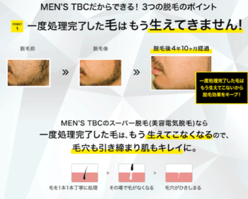 MEN`S TBC