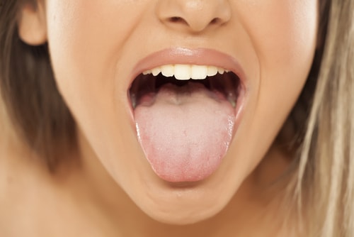 舌 舌苔