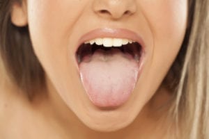 舌苔　舌