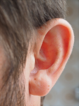 耳垢の確認